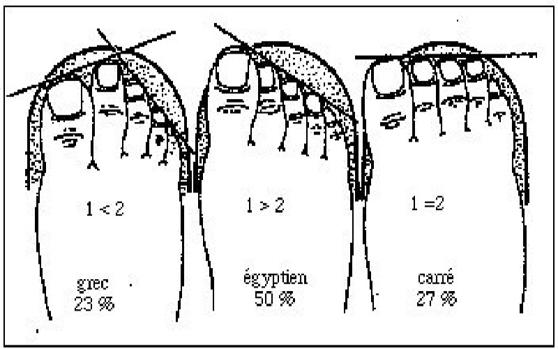 Formes des pieds